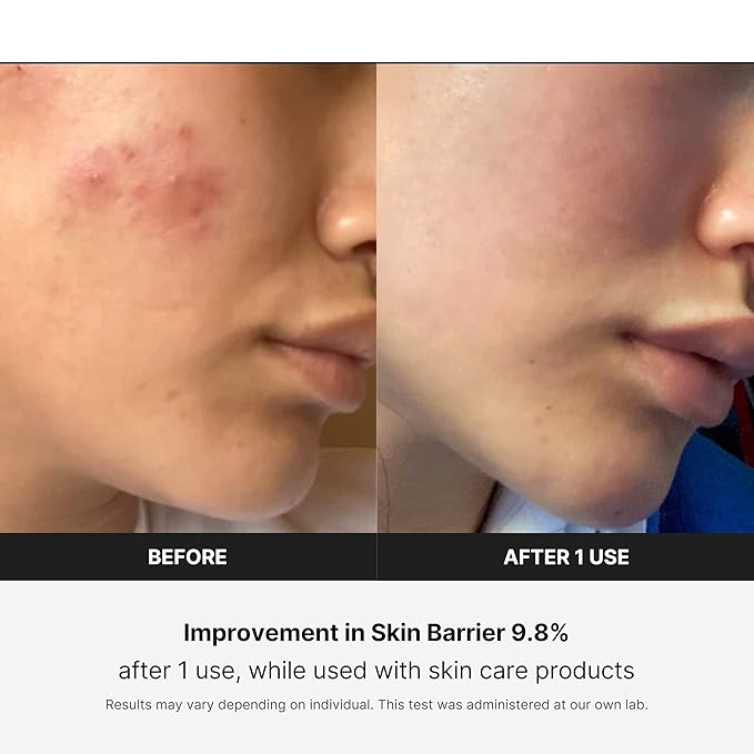 BOOSTER PRO: EL REVITALIZADOR DE PIEL ANTI-ENVEJECIMIENTO 6 EN 1 QUE MERECES