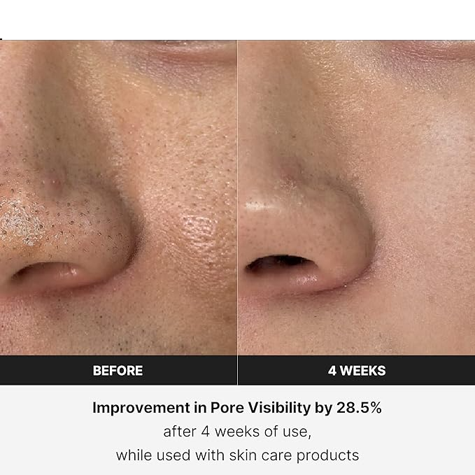 BOOSTER PRO: EL REVITALIZADOR DE PIEL ANTI-ENVEJECIMIENTO 6 EN 1 QUE MERECES