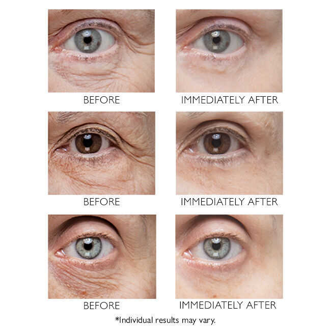 ✨ Instant FirmX Eye - ¡Lifting instantáneo sin agujas! ✨