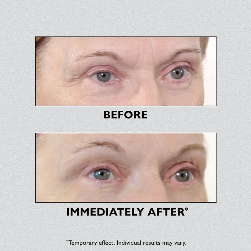 ✨ Instant FirmX Eye - ¡Lifting instantáneo sin agujas! ✨