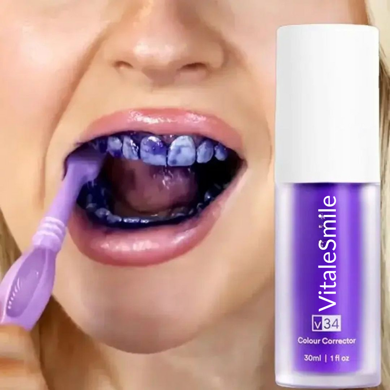 Branqueador Dental SmileKit